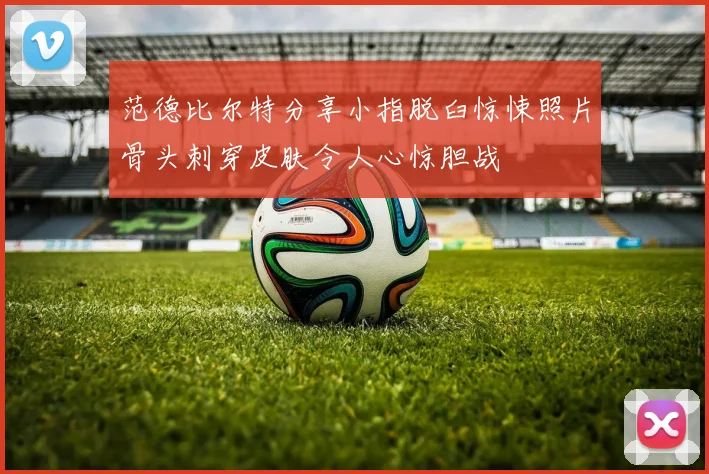 范德比尔特分享小指脱臼惊悚照片骨头刺穿皮肤令人心惊胆战